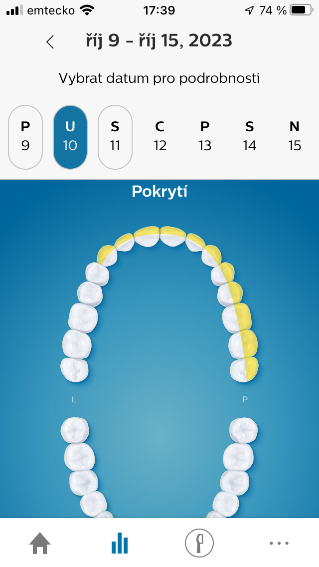 Pokrytí zubů Obrázek pokrytí zubů