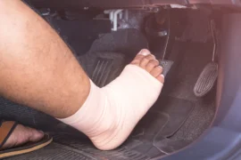 Pokuta za řízení se sádrou: sankce se může vyšplhat až na 2&nbsp;000&nbsp;Kč, Češi to často nevědomky porušují. Problémy bude dělat i&nbsp;pojišťovna