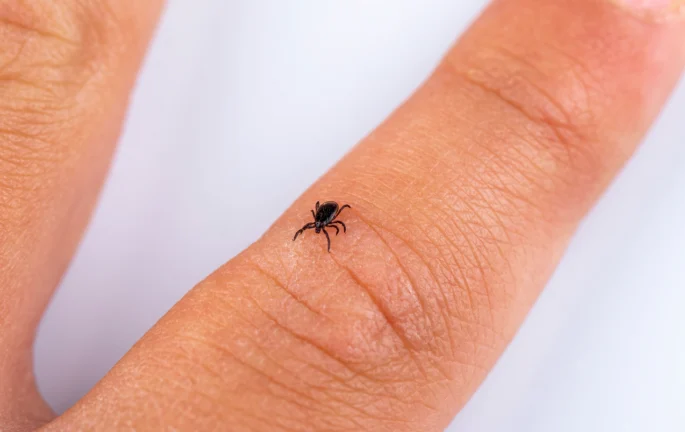 Jak správně vyndat klíště: Češi věří starým mýtům s&nbsp;mastmi a&nbsp;olejíčky. Správný postup je s&nbsp;pinzetou